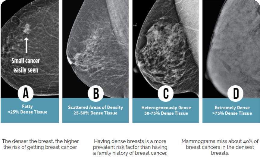 Beam - Breast Ultrasound