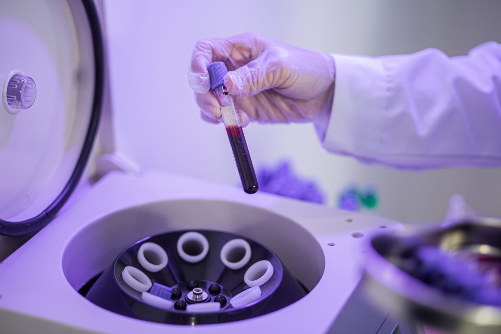 Asia Chinese female doctor put blood samples in vials on a centrifuge machine. Covid-19 blood test