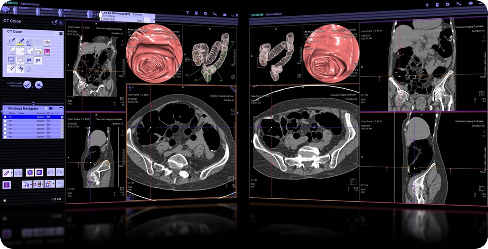 Beam - CT Scan Result